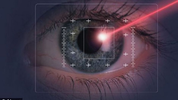 Tia laser dùng để phẫu thuật mắt